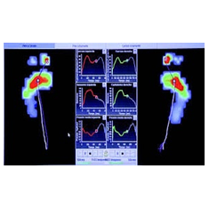 huella plantar en  podologo bogota, podologia bogota su alternativa
